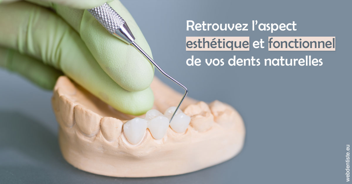 https://dr-gerbay-triollier-caroline.chirurgiens-dentistes.fr/Restaurations dentaires 1