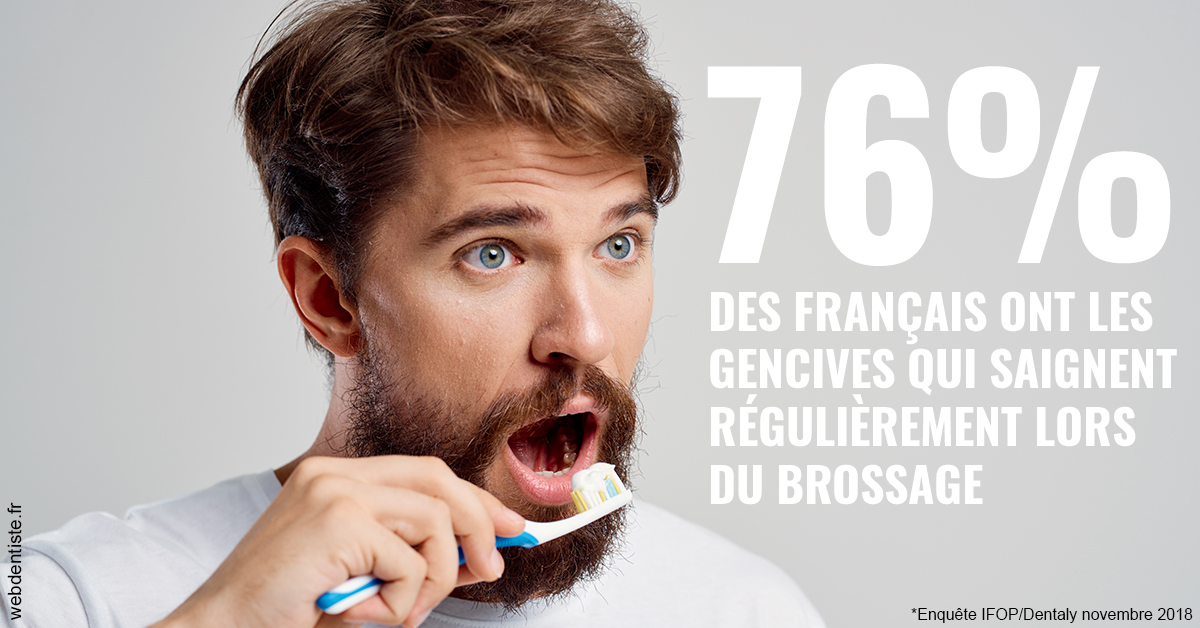 https://dr-gerbay-triollier-caroline.chirurgiens-dentistes.fr/76% des Français 2