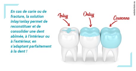 https://dr-gerbay-triollier-caroline.chirurgiens-dentistes.fr/L'INLAY ou l'ONLAY
