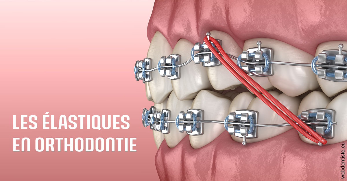 https://dr-gerbay-triollier-caroline.chirurgiens-dentistes.fr/Elastiques orthodontie 2